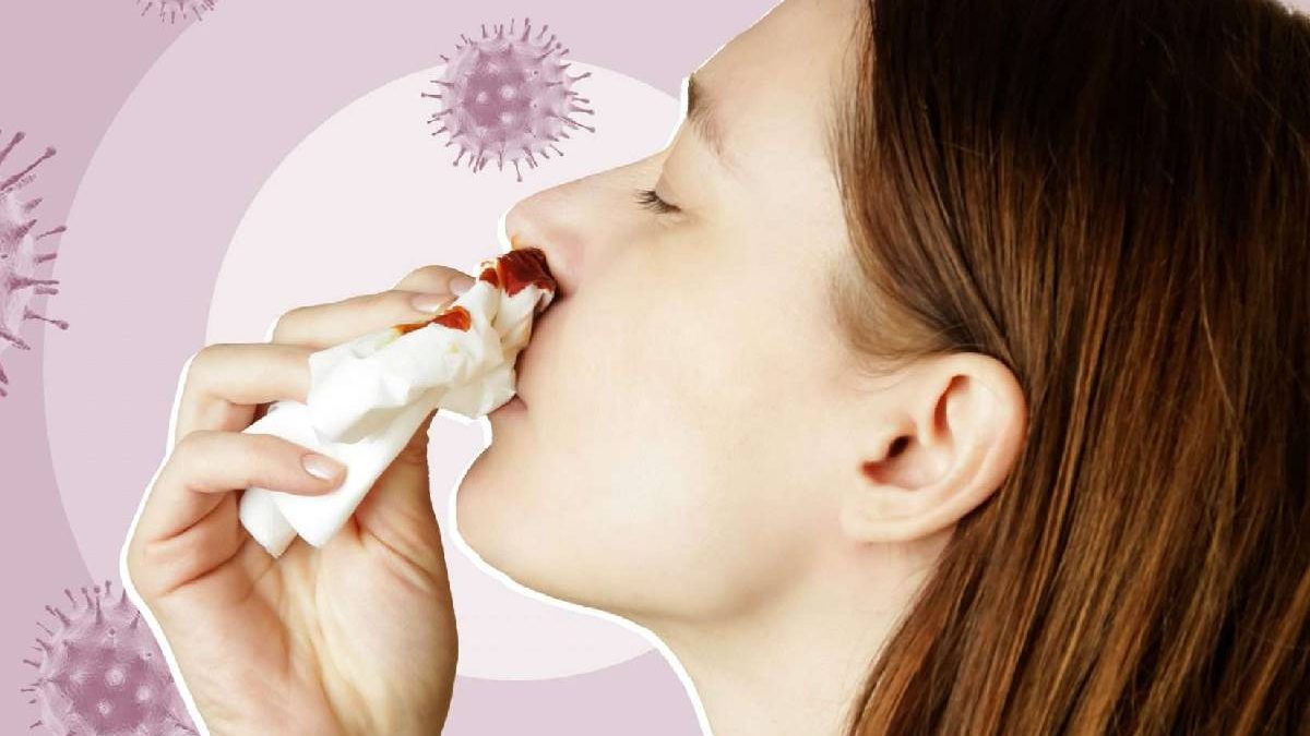 COVID-19: Symptom of Your Nose Bleeding?