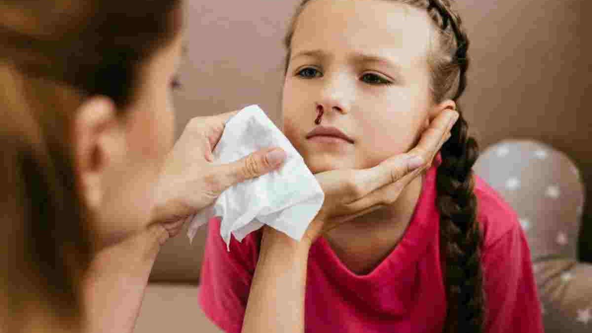 COVID-19: Symptom of Your Nose Bleeding?
