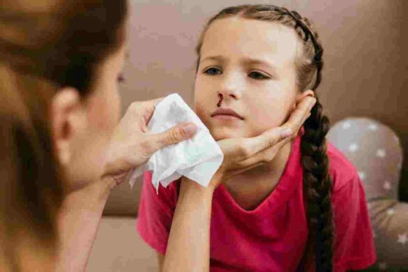 COVID-19_ Symptom of Your Nose Bleeding_