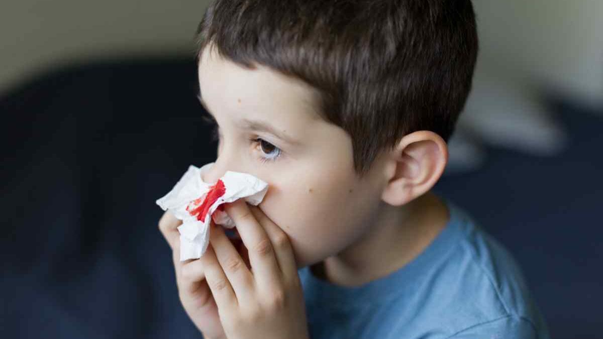 COVID-19: Symptom of Your Nose Bleeding?